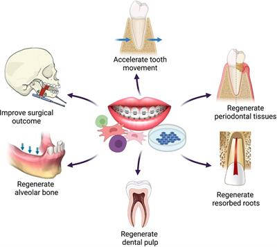 Applications of regenerative techniques in adult orthodontics